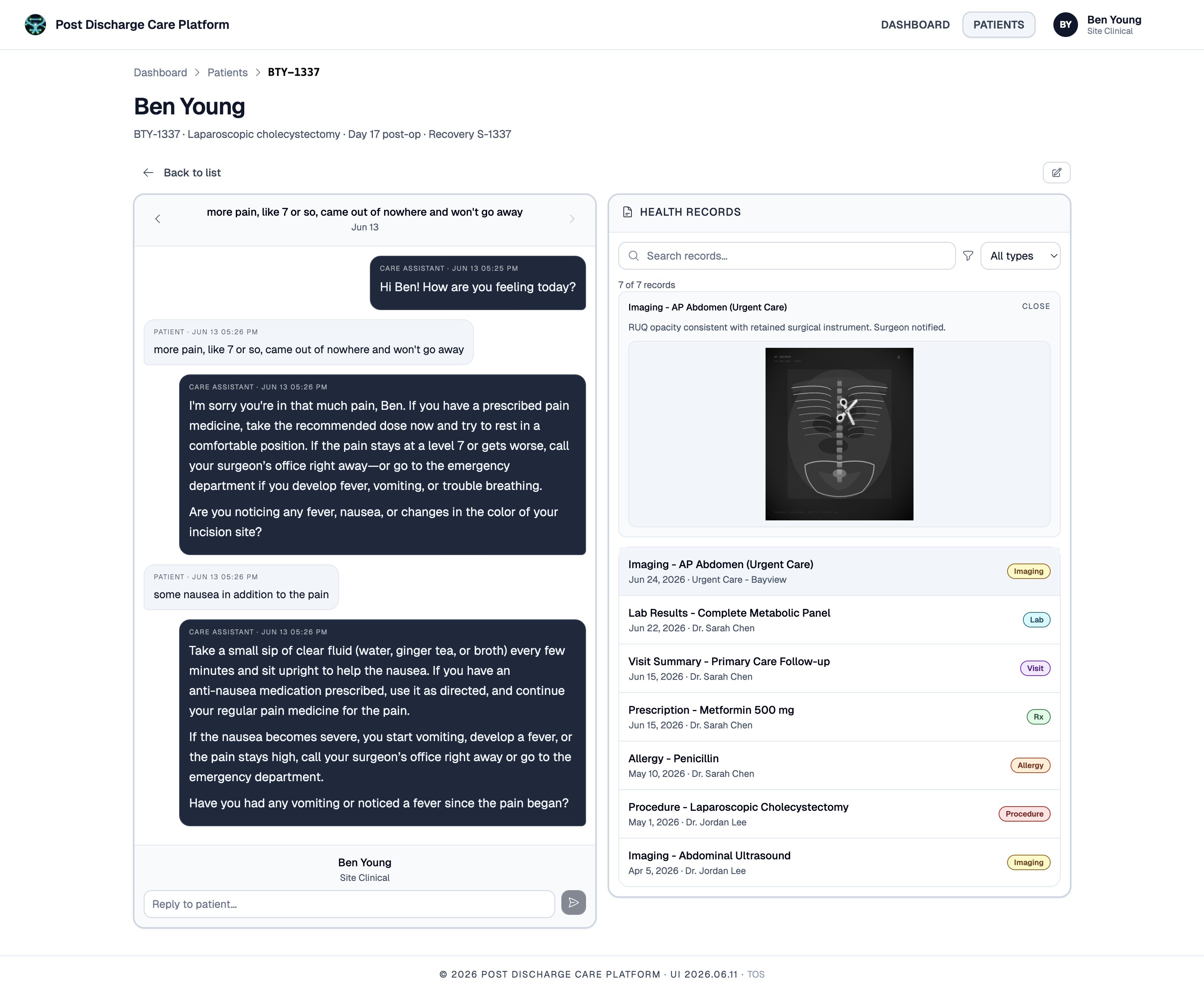 AI care assistant and patient record view